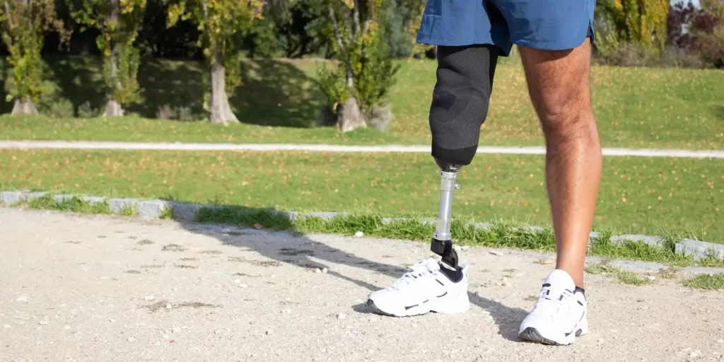a person with a prosthetic leg standing on a path in what appears to be a park setting. The prosthetic limb is visible from the knee down, and the person is wearing shorts and white sneakers, which may suggest that they are engaged in outdoor activities or exercise. Modern prosthetic limbs are often made with advanced materials, including EVA foam, to enhance comfort and support, enabling wearers to participate in a variety of physical activities.